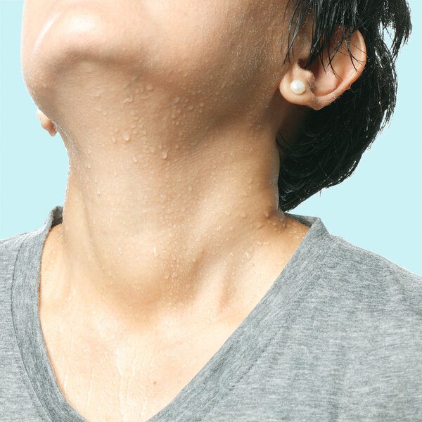 焦虑症出汗怎么办