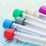 缩略图–重度焦虑症怎么检查确诊–焦虑症治疗